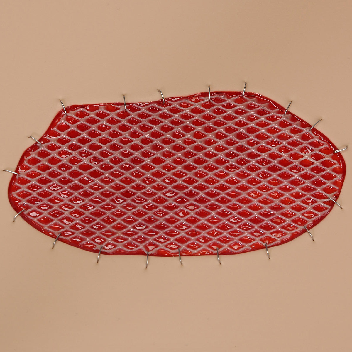 Skin Graft Wound Board, light - 3B Scientific