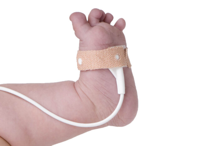 Neonatal Wrap Sensor - Huntleigh