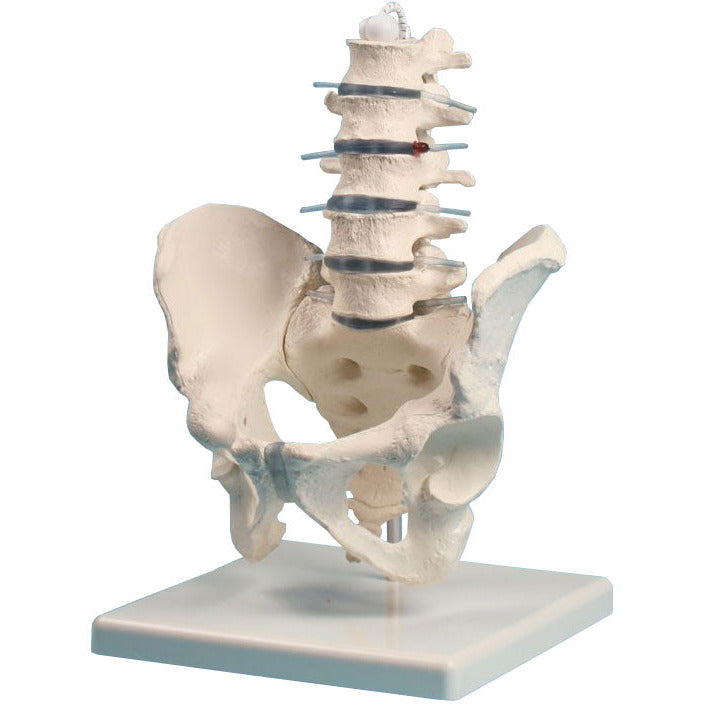 Lumbar Spine Model with Pelvis – Medisave UK