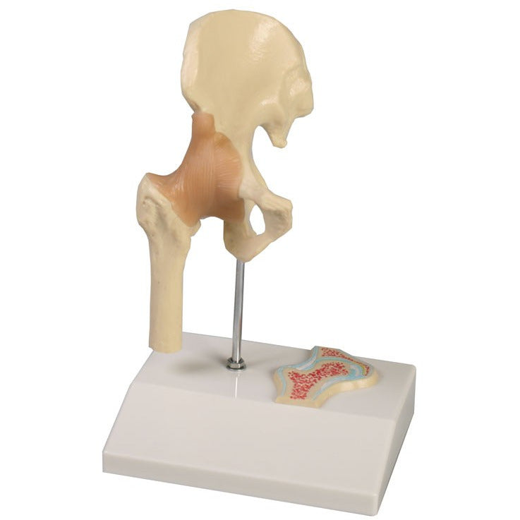 Miniature Hip Joint with Cross Section – Medisave UK