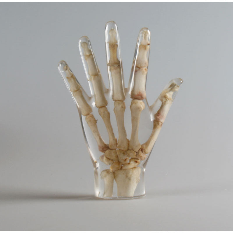 X-Ray Phantom Hand - Transparent - Erler Zimmer