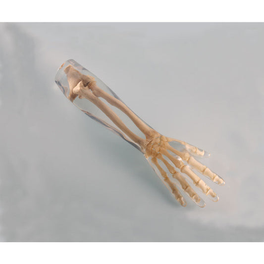 X-Ray Phantom Lower Arm - Transparent - Erler Zimmer