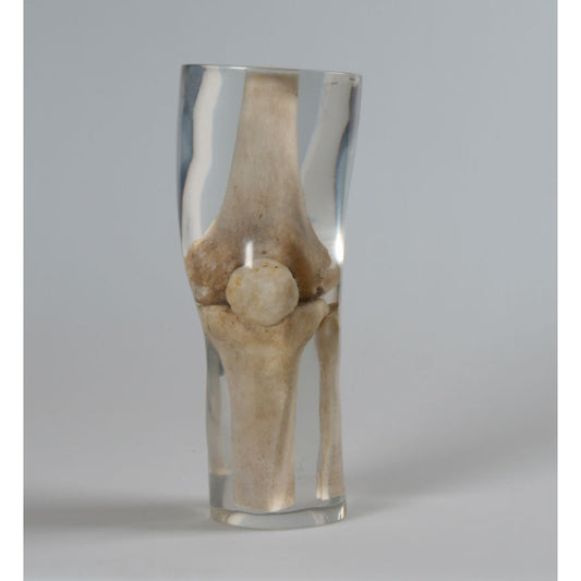 X-Ray Phantom Knee - Transparent - Erler Zimmer