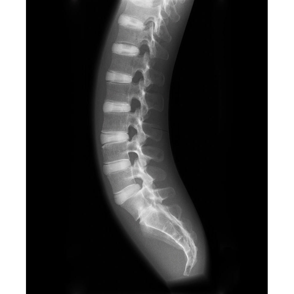 X-Ray Phantom Spine - Opaque - Erler Zimmer