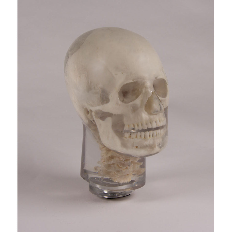 X-Ray Phantom Head with Cervical Vertebrae - Transparent - Erler Zimmer