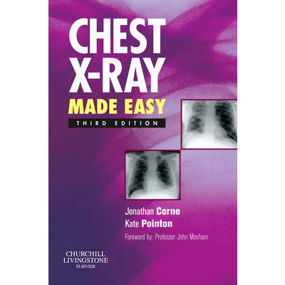 Chest X-Ray Made Easy - 3rd Edition 