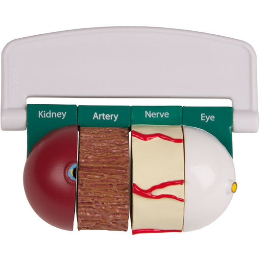 4-Piece Diabetes Model - Erler Zimmer