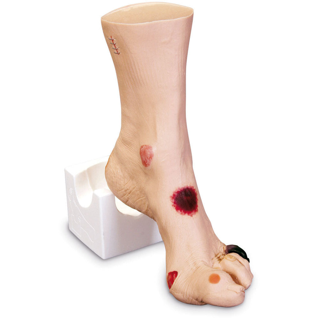 Wound Foot “Wilma” - Erler Zimmer