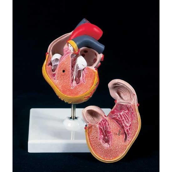 2 Part Heart Model with LVH