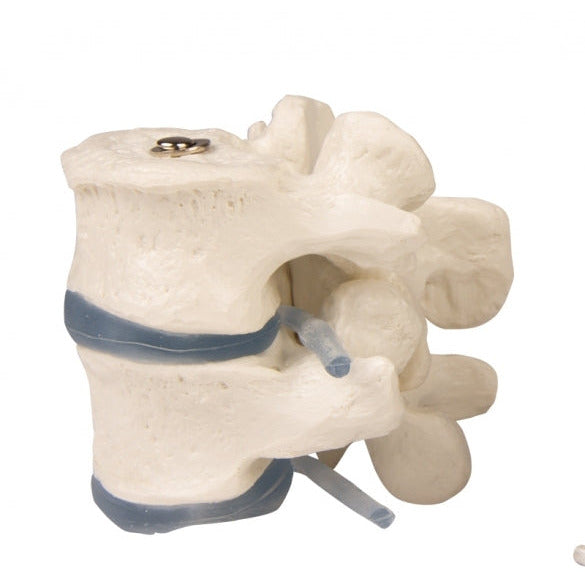 2 Lumbar Vertebrae - Erler Zimmer