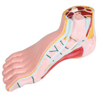 Hollow Foot Model - Life-Size