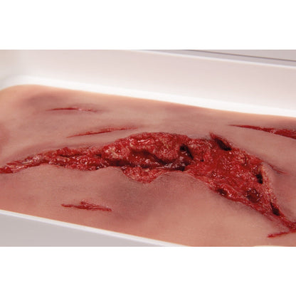 Wound Moulage Laceration, Large With Bleeding Function - Erler Zimmer