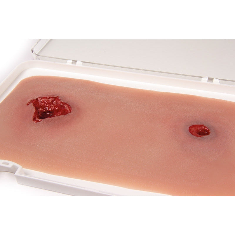 Wound Moulage Bullet Hole, Leg With Bleeding Function - Erler Zimmer