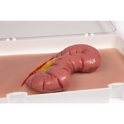 Wound Moulage Protrusion Of Large Intestines - Erler Zimmer