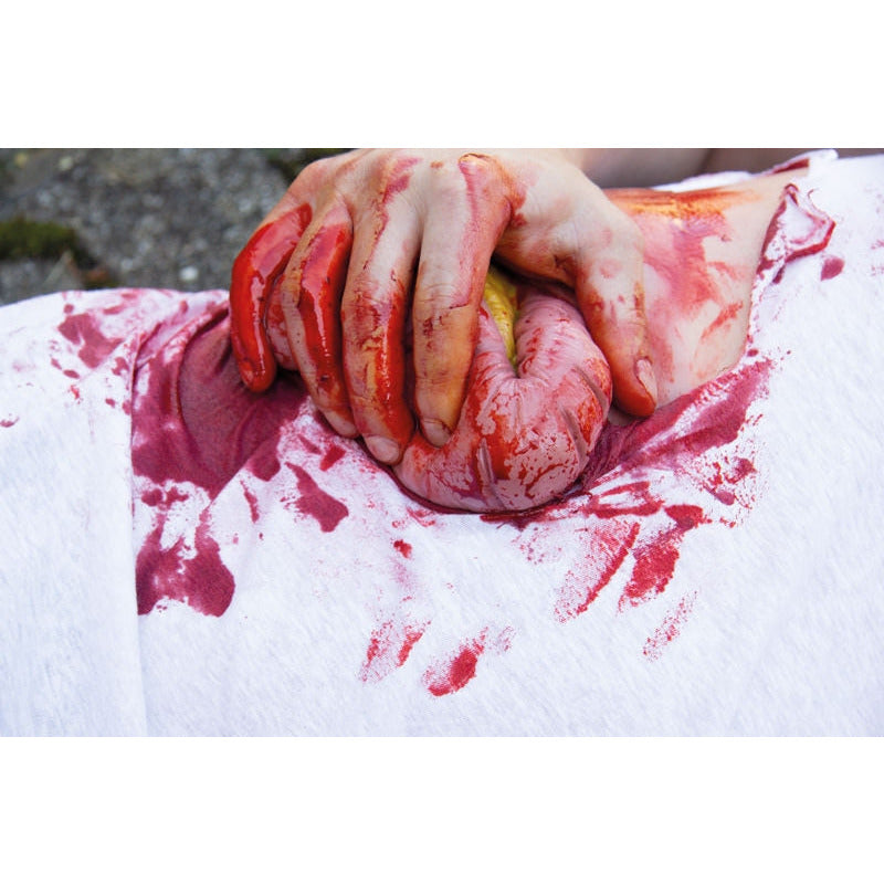 Wound Moulage Protrusion Of Large Intestines - Erler Zimmer